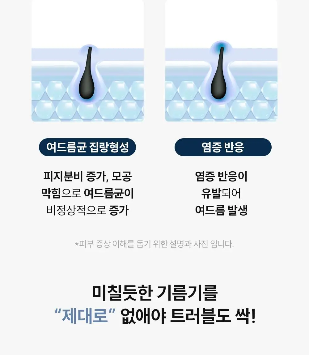 [등드름/체취케어] 낫포유 지성피부전용 등드름/가드름 클리어 올인원 바디워시 포맨 500ml 상세페이지 7